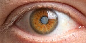 A Guide to Cataract Eye Surgery: What to Expect Before and After